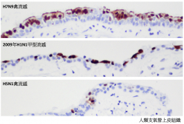 圖片顯示人類支氣管上皮組織,研究人員比較了甲型禽流感(H7N9)病毒,2009年甲型流感(H1N1)病毒(俗稱豬流感)、以及高致病性甲型禽流感(H5N1)病毒在體外培養的人類支氣管組織的感染能力。 圖中棕色部分顯示被病毒感染的細胞,藍色部分顯示非感染的細胞。H7N9病毒能導致廣泛支氣管上皮細胞感染,情況與2009年的甲型流感(H1N1)病毒相似。相反,H5N1病毒只能作出有限度感染。